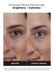 C5 Super Boost Moisturizer