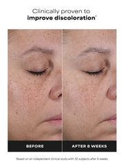 25% Vitamin C + Glutathione Clinical Serum