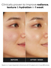 7% Ectoin + Hyaluronic Acid Milky Hydrating Serum