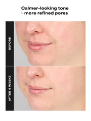 4% BHA Advanced Exfoliating Serum Toner