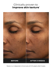 6% Mandelic Acid + 2% Lactic Acid Liquid Exfoliant
