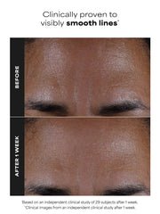 2% BHA Liquid Exfoliant