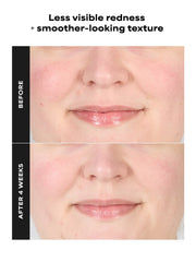 1% BHA Gentle Exfoliating Gel Toner