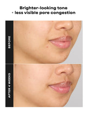 4% BHA Advanced Exfoliating Serum Toner