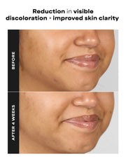 1% BHA Gentle Exfoliating Gel Toner