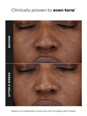 25% Vitamin C + Glutathione Clinical Serum