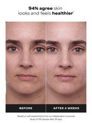 1% Retinol Treatment